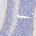 SEC61B Antibody in Immunohistochemistry (Paraffin) (IHC (P))