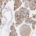 SEC61B Antibody in Immunohistochemistry (Paraffin) (IHC (P))