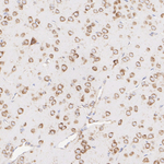 SEC61B Antibody in Immunohistochemistry (Paraffin) (IHC (P))