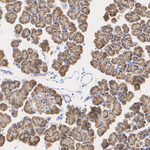 SEC61B Antibody in Immunohistochemistry (Paraffin) (IHC (P))