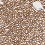 SEC61B Antibody in Immunohistochemistry (Paraffin) (IHC (P))