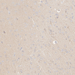 CCS Antibody in Immunohistochemistry (Paraffin) (IHC (P))
