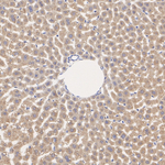 CCS Recombinant Rabbit Monoclonal Antibody (PSH09-50)