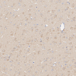CCS Antibody in Immunohistochemistry (Paraffin) (IHC (P))