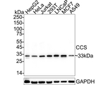 CCS Antibody in Western Blot (WB)