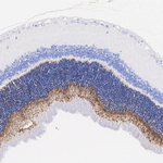 PDC Antibody in Immunohistochemistry (Paraffin) (IHC (P))