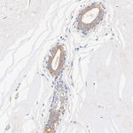 MMP1 Antibody in Immunohistochemistry (Paraffin) (IHC (P))