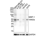 MMP1 Antibody in Western Blot (WB)