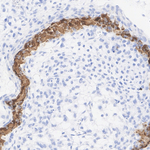 Bone SialoProtein 2 Recombinant Rabbit Monoclonal Antibody (PSH09-64)