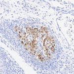Bone SialoProtein 2 Antibody in Immunohistochemistry (Paraffin) (IHC (P))