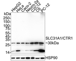 CTR1 Recombinant Rabbit Monoclonal Antibody (PSH09-67)