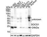 SOCS1 Recombinant Rabbit Monoclonal Antibody (PSH09-68)