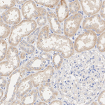 DHODH Antibody in Immunohistochemistry (Paraffin) (IHC (P))