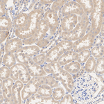 DHODH Antibody in Immunohistochemistry (Paraffin) (IHC (P))