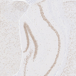 MYT1L Antibody in Immunohistochemistry (Paraffin) (IHC (P))
