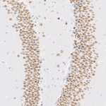 MYT1L Recombinant Rabbit Monoclonal Antibody (PSH09-71)