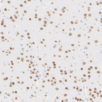 MYT1L Antibody in Immunohistochemistry (Paraffin) (IHC (P))
