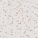 MYT1L Antibody in Immunohistochemistry (Paraffin) (IHC (P))