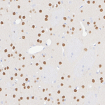 MYT1L Antibody in Immunohistochemistry (Paraffin) (IHC (P))