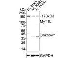 MYT1L Antibody in Western Blot (WB)