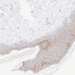Nectin 4 Antibody in Immunohistochemistry (Paraffin) (IHC (P))