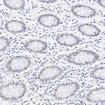 SSRP1 Antibody in Immunohistochemistry (Paraffin) (IHC (P))