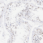 SSRP1 Antibody in Immunohistochemistry (Paraffin) (IHC (P))