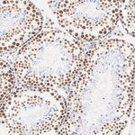 SSRP1 Recombinant Rabbit Monoclonal Antibody (PSH09-75)