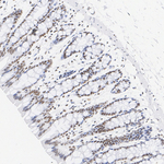 SSRP1 Antibody in Immunohistochemistry (Paraffin) (IHC (P))