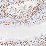 SSRP1 Antibody in Immunohistochemistry (Paraffin) (IHC (P))