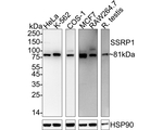 SSRP1 Antibody in Western Blot (WB)