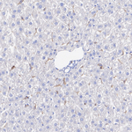 CSF1R Antibody in Immunohistochemistry (Paraffin) (IHC (P))