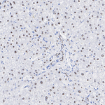 MOZ Antibody in Immunohistochemistry (Paraffin) (IHC (P))