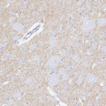 DRD2 Antibody in Immunohistochemistry (Paraffin) (IHC (P))