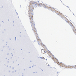 DRD2 Antibody in Immunohistochemistry (Paraffin) (IHC (P))