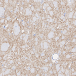 DRD2 Antibody in Immunohistochemistry (Paraffin) (IHC (P))