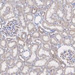 SCO2 Antibody in Immunohistochemistry (Paraffin) (IHC (P))