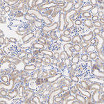 SCO2 Antibody in Immunohistochemistry (Paraffin) (IHC (P))