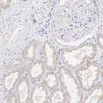 SCO2 Antibody in Immunohistochemistry (Paraffin) (IHC (P))