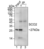 SCO2 Antibody in Immunoprecipitation (IP)