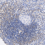 CD40 Antibody in Immunohistochemistry (Paraffin) (IHC (P))