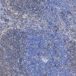 CD40 Antibody in Immunohistochemistry (Paraffin) (IHC (P))