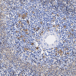 CD40 Antibody in Immunohistochemistry (Paraffin) (IHC (P))