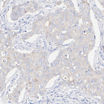 GDF15 Antibody in Immunohistochemistry (Paraffin) (IHC (P))