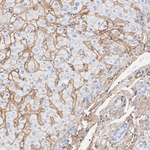 CD81 Recombinant Rabbit Monoclonal Antibody (PSH10-26)
