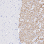 Dopamine Transporter Antibody in Immunohistochemistry (Paraffin) (IHC (P))