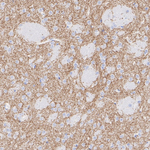 Dopamine Transporter Recombinant Rabbit Monoclonal Antibody (PSH10-49)