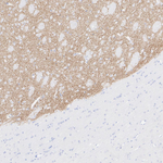 Dopamine Transporter Antibody in Immunohistochemistry (Paraffin) (IHC (P))