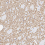Dopamine Transporter Antibody in Immunohistochemistry (Paraffin) (IHC (P))