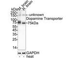 Dopamine Transporter Antibody in Western Blot (WB)